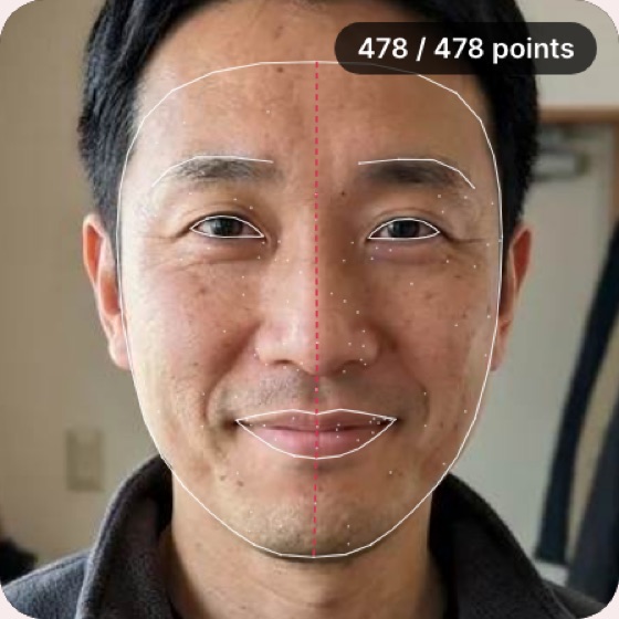 Face Symmetry Test example: 478 landmarks measured on a sample selfie
